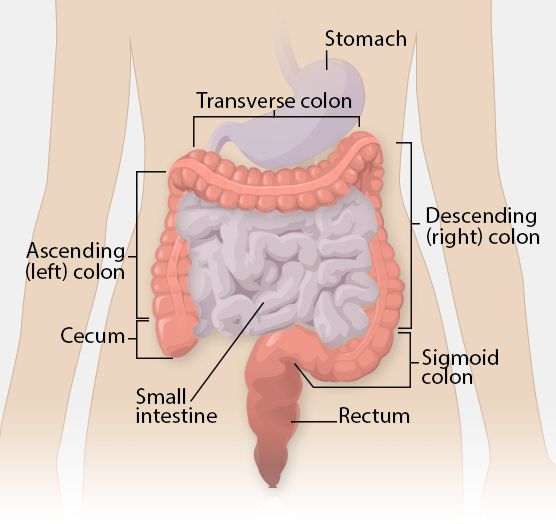 Illustration of laparoscopic colon surgery procedure