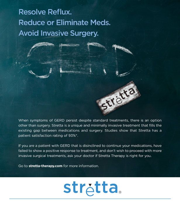 Stretta procedure for GERD treatment