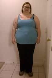 Before Bariatric Surgery