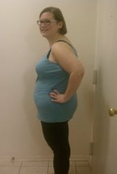 After Bariatric Surgery